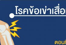 โรคข้อเข่าเสื่อม ตอนที่ 2