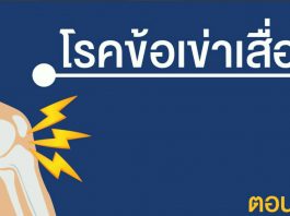 โรคข้อเข่าเสื่อม ตอนที่ 2