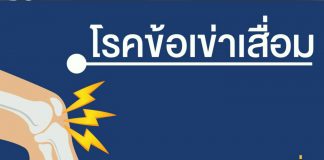 โรคข้อเข่าเสื่อม ตอนที่ 2