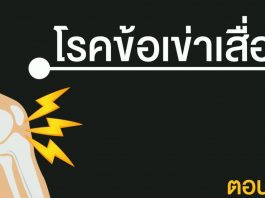 โรคข้อเข่าเสื่อม ตอนที่ 1
