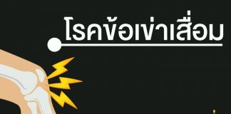 โรคข้อเข่าเสื่อม ตอนที่ 1