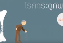 โรคกระดูกพรุน ตอนที่ 1: นิยามของโรค / ผู้ป่วยกลุ่มเสี่ยง