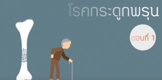 โรคกระดูกพรุน ตอนที่ 1: นิยามของโรค / ผู้ป่วยกลุ่มเสี่ยง