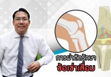 โรคข้อเข่าเสื่อม ตอนที่ 5: “ผ่าทีละข้าง หรือสองข้างดี”