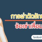 โรคข้อเข่าเสื่อม