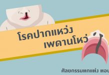 ศัลยกรรมตกแต่งตอนที่ 3: โรคปากแหว่ง เพดานโหว่