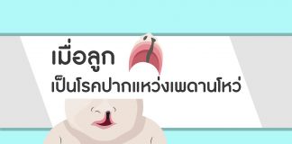 คุยกับหมอศัลยกรรมตกแต่ง ตอนที่ 5: เมื่อลูกเป็นโรคปากแหว่ง เพดานโหว่ คุยกับหมอศัลยกรรมตกแต่ง ตอนที่ 5: เมื่อลูกเป็นโรคปากแหว่ง เพดานโหว่