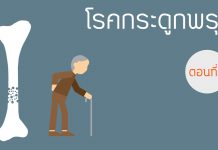 โรคกระดูกพรุน ตอนที่ 2: อาการของโรค / มวลกระดูกสูงสุด โรคกระดูกพรุน ตอนที่ 2: อาการของโรค มวลกระดูกสูงสุด