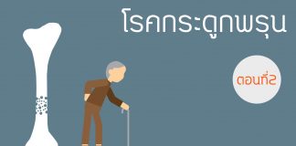 โรคกระดูกพรุน ตอนที่ 2: อาการของโรค / มวลกระดูกสูงสุด โรคกระดูกพรุน ตอนที่ 2: อาการของโรค มวลกระดูกสูงสุด