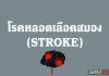 โรคหลอดเลือดสมอง (Stroke) คืออะไร