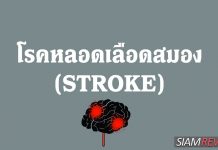 โรคหลอดเลือดสมอง (Stroke) คืออะไร โรคหลอดเลือดสมอง (Stroke) คืออะไร