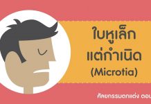 ศัลยกรรมตกแต่ง ตอนที่ 7: ใบหูเล็กแต่กำเนิด