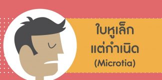 ศัลยกรรมตกแต่ง ตอนที่ 7: ใบหูเล็กแต่กำเนิด ศัลยกรรมตกแต่ง ตอนที่ 7: ใบหูเล็กแต่กำเนิด