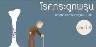 โรคกระดูกพรุน ตอนที่ 5: กระดูกหักจากโรคกระดูกพรุน (ต่อ) โรคกระดูกพรุน ตอนที่ 5: กระดูกหักจากโรคกระดูกพรุน (ต่อ)
