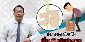 ปวดหลัง ตอนที่ 4: โรคกระดูกสันหลังเสื่อมทับเส้นประสาท ปวดหลัง ตอนที่ 4: โรคกระดูกสันหลังเสื่อมทับเส้นประสาท