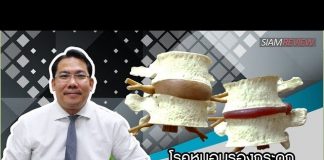 ปวดหลัง ตอนที่ 5: โรคหมอนรองกระดูกแตกทับเส้นประสาท