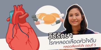 หลอดเลือดหัวใจ ตอนที่ 5: วิธีรักษาโรคหลอดเลือดหัวใจตีบ