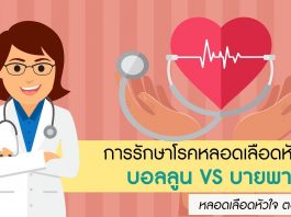 หลอดเลือดหัวใจ ตอนที่ 6: การรักษาโรคหลอดเลือดหัวใจด้วยบอลลูน VS บายพาส