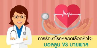 หลอดเลือดหัวใจ ตอนที่ 6: การรักษาโรคหลอดเลือดหัวใจด้วยบอลลูน VS บายพาส