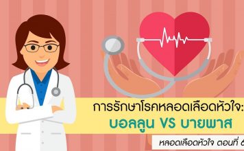 หลอดเลือดหัวใจ ตอนที่ 6: การรักษาโรคหลอดเลือดหัวใจด้วยบอลลูน VS บายพาส