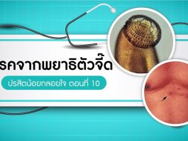 ปรสิตน้อยกลอยใจ ตอนที่ 10: โรคจากพยาธิตัวจี๊ด