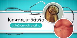 ปรสิตน้อยกลอยใจ ตอนที่ 10: โรคจากพยาธิตัวจี๊ด
