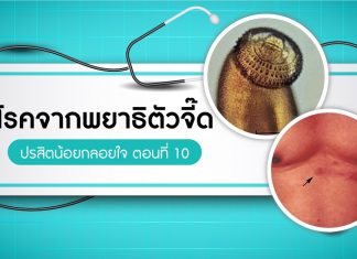 ปรสิตน้อยกลอยใจ ตอนที่ 10: โรคจากพยาธิตัวจี๊ด